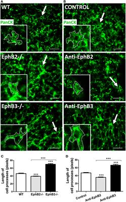 Can a Proper T-Cell Development Occur in an Altered Thymic Epithelium? Lessons From EphB-Deficient Thymi